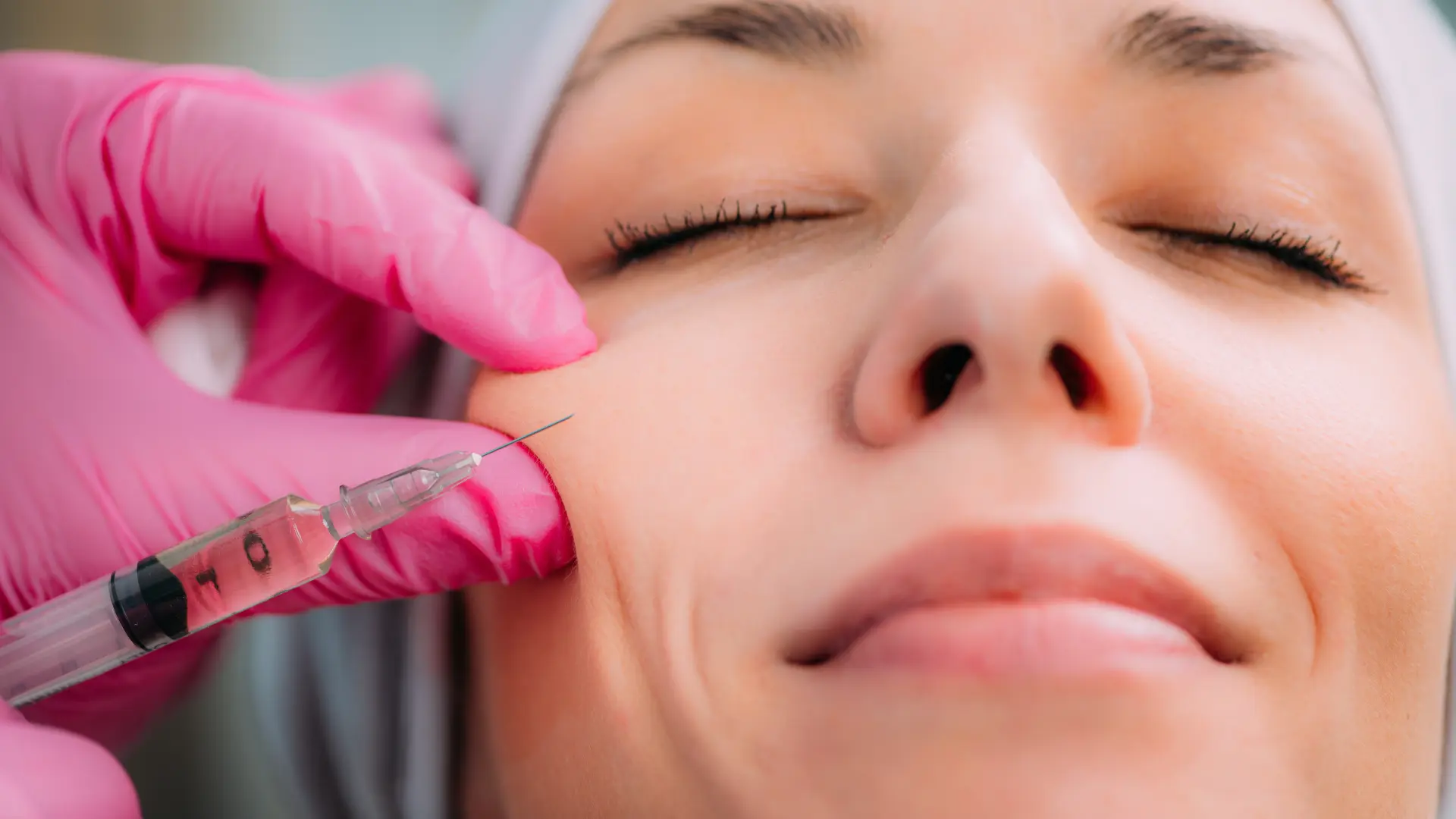 Aesthetic supplies USA. Teosyal vs Juvederm: Comparing Dermal Fillers